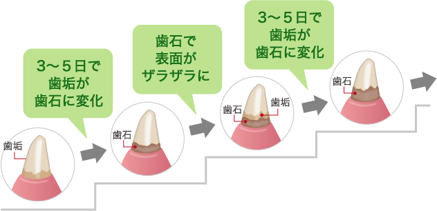 ■ペットは歯垢が歯石に変わりやすい！？