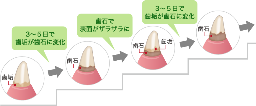 ■ペットは歯垢が歯石に変わりやすい！？