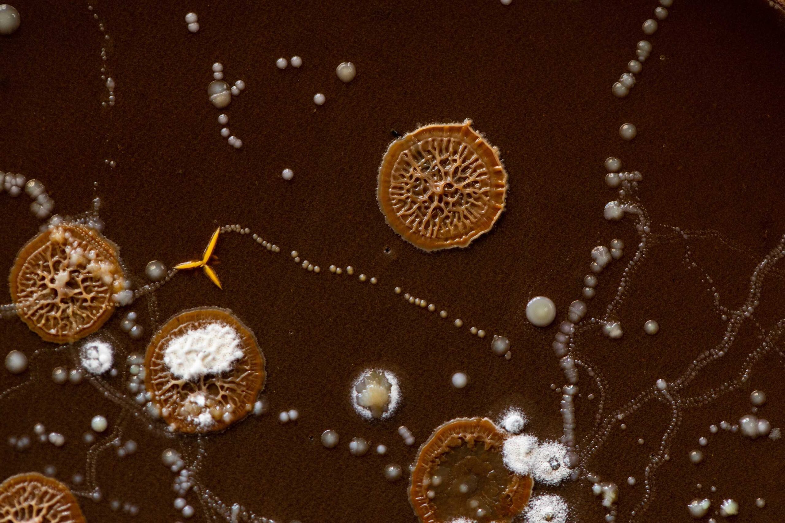 その他の微生物