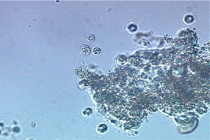 【写真3.白濁りの原因生物（繊毛虫の仲間）】